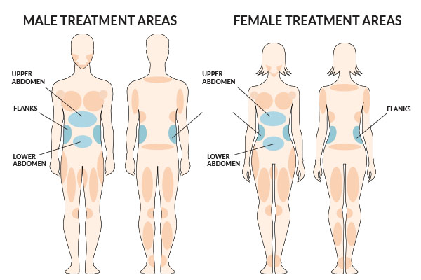 Liposuction treatment