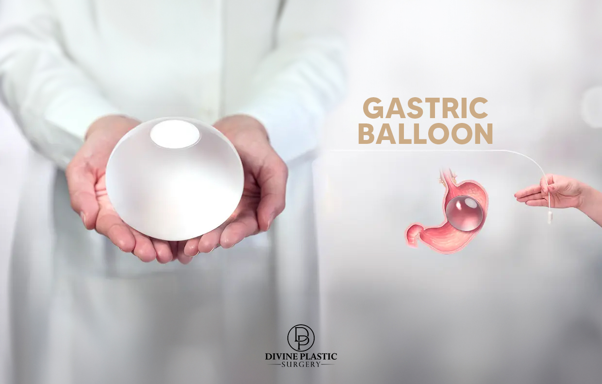 Gastric Balloon