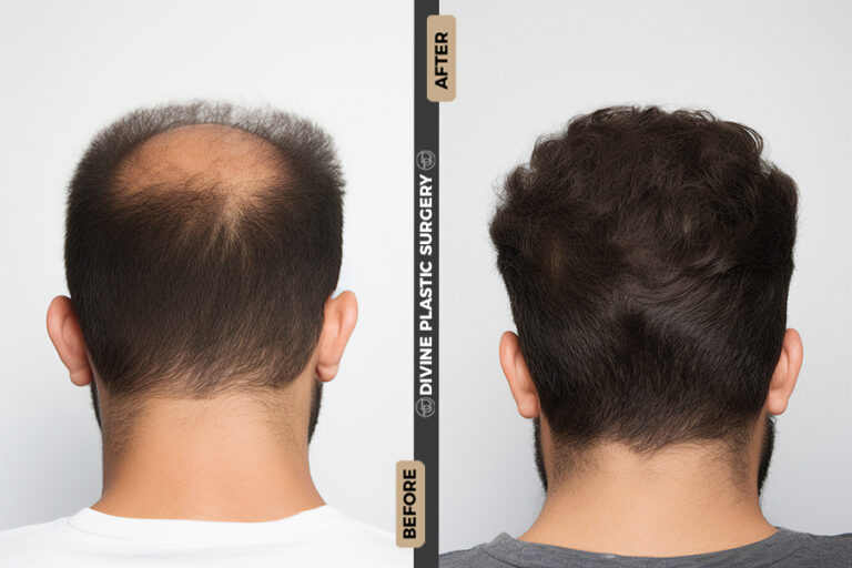 HAIR3