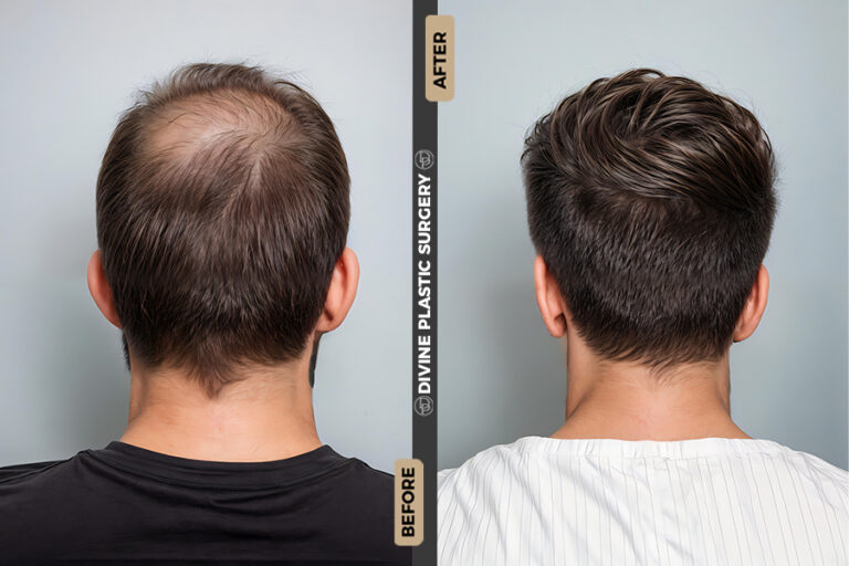 BA HAIR5