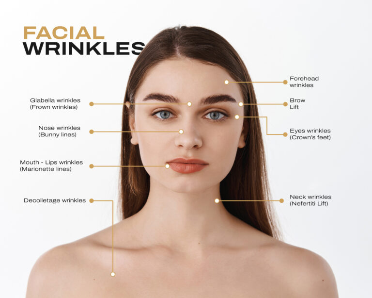 Facelift Info IMG 3360 1