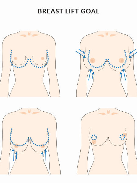 most-popular-plastic-surgeries-2025