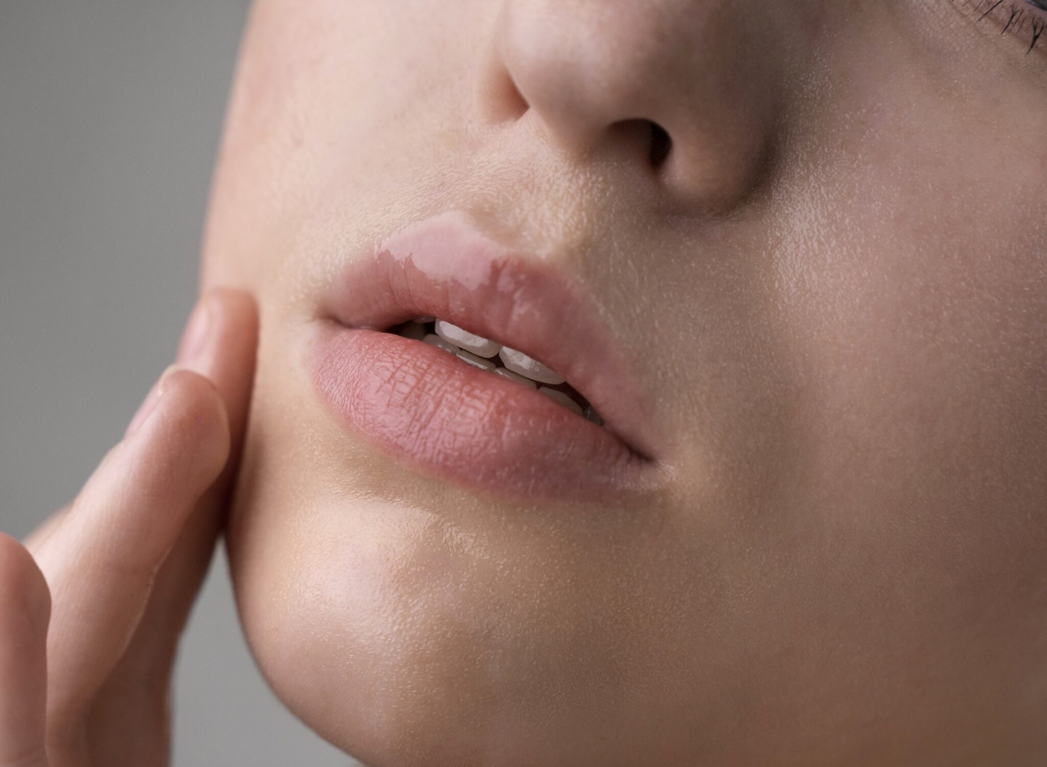 lip-filler-miami-shape-recovery