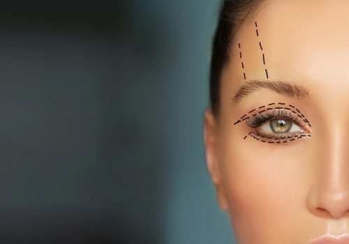 blefaroplastia-scaled.jpg blefaroplastia-scaled.jpg